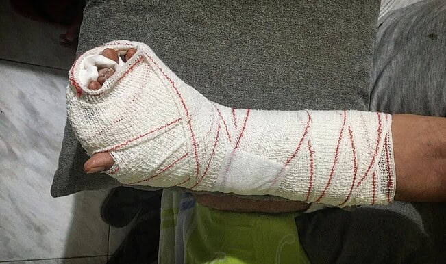 À Barcelone, amputé d'un doigt pour mettre fin à un vol 4 doigt amputé vol barcelone