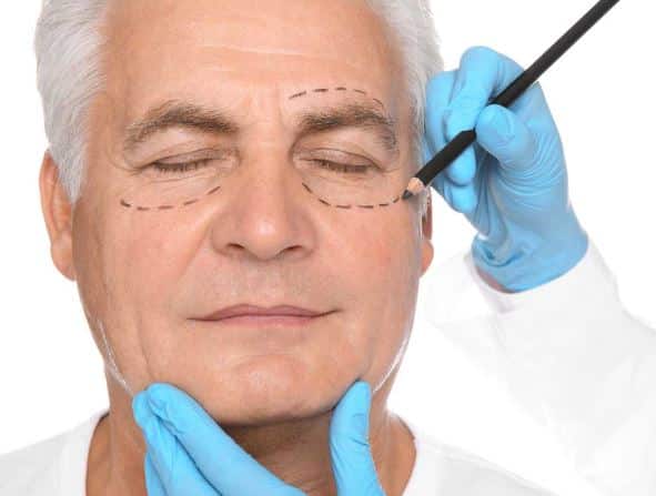 Blépharoplastie à Barcelone. Chirurgie paupières Antiaging Group