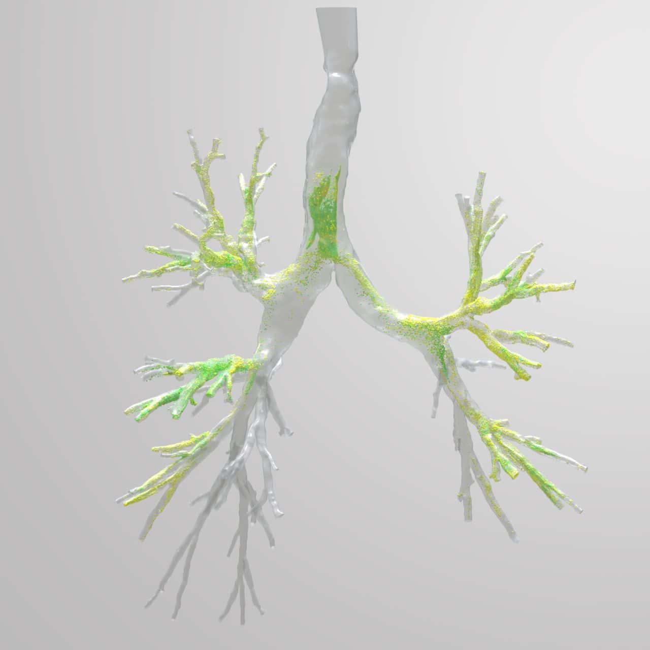 Découvrez si votre quartier de Barcelone est dangeureusement pollué 5 Illustration d'un poumon humain avec ses branches bronchiques, mettant en évidence la structure interne des voies respiratoires.